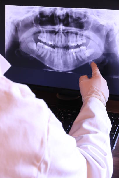 Best Broken or Cracked Tooth Emergency Dentist in Beale Af, CA