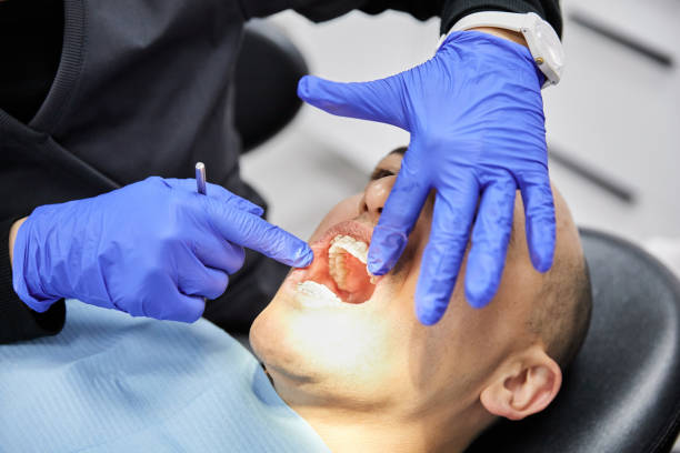 Best Mobile Emergency Dentist in Beale Af, CA