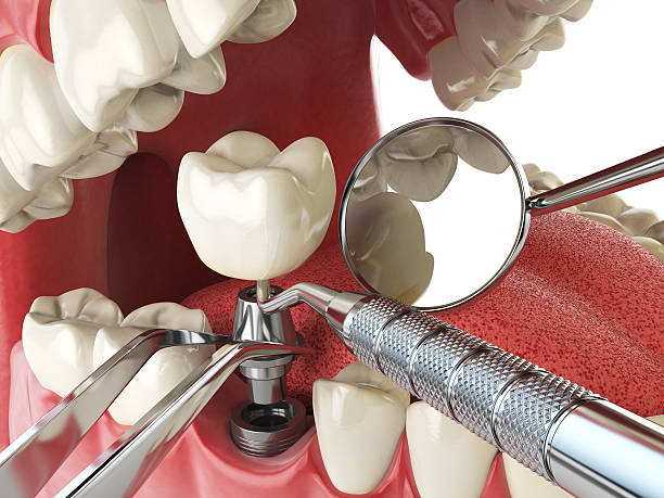 Best Emergency Dentist for Special Needs Patients in Beale Af, CA